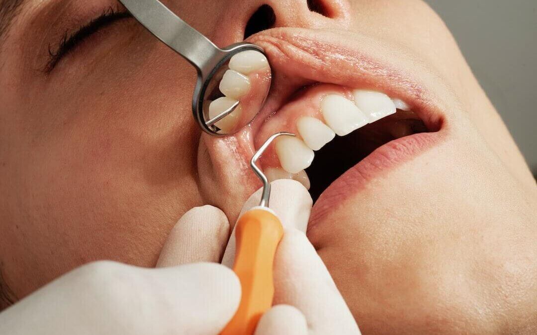 Best dentist in Richmond ky