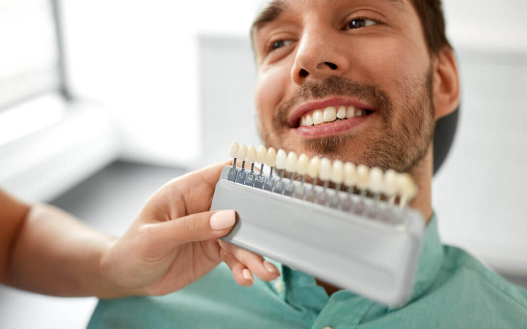 Brighten Your Smile with Teeth Whitening in Richmond